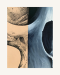 DERMA// EXPOSED SKULL 2